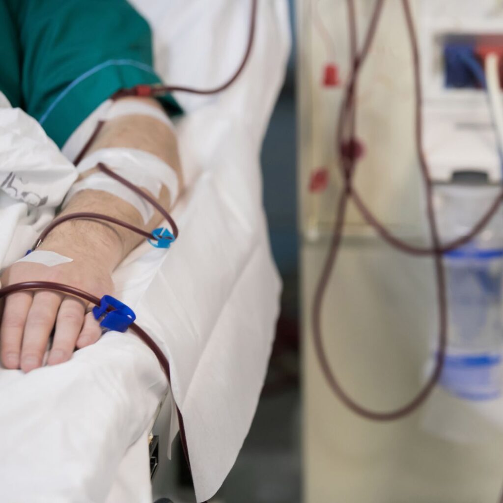 Dialysis